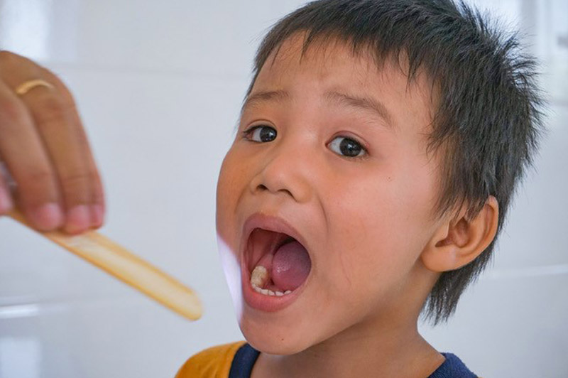 Zahngesundheit für Kinder in Vietnam